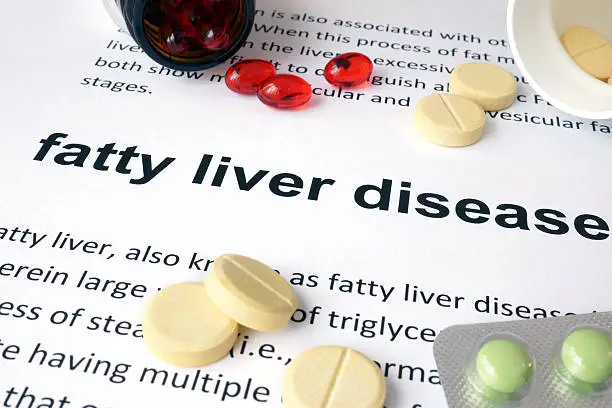 Fatty Liver Disease? Here's Exactly What To Eat And Avoid Daily